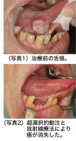 写真1 写真2の画像