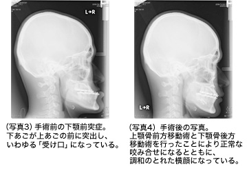 写真3 写真4の画像