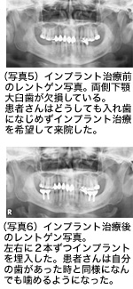 写真5 写真6の画像