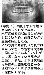 写真13の画像