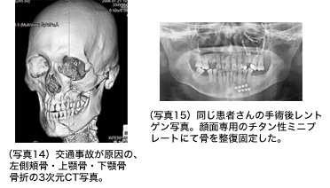 写真14 写真15の画像