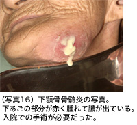 写真16の画像